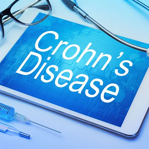 Crohn's Disease Treatment Near Me in Columbus, OH. Chiropractor For Crohn's Disease Relief.